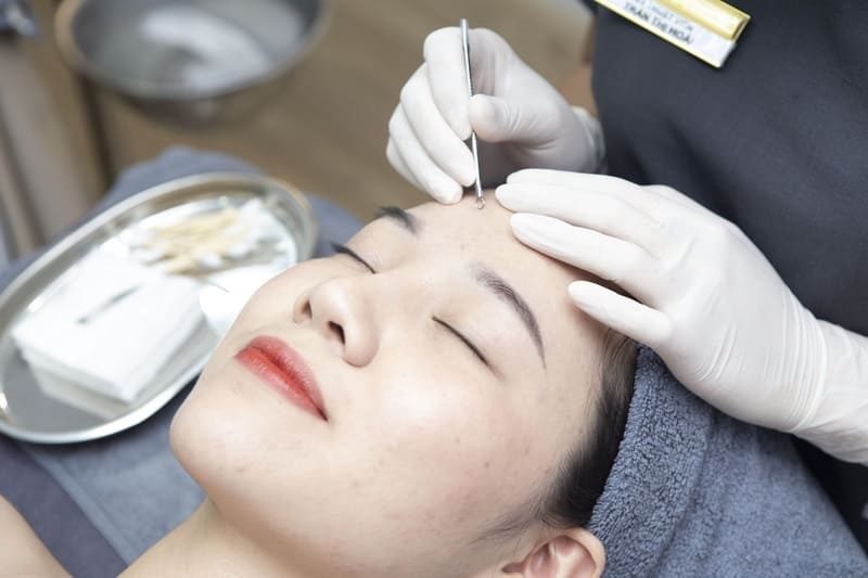 Lựa chọn phương pháp trị nám phù hợp và đặt hiệu quả nhất với khách hàng