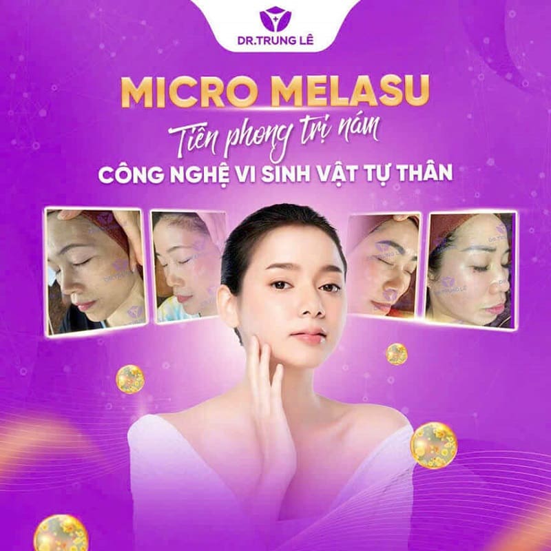 Hãy tham khảo tại Drtrungle.com, nơi cung cấp các công nghệ làm đẹp tiên tiến, đáp ứng nhu cầu của mọi khách hàng